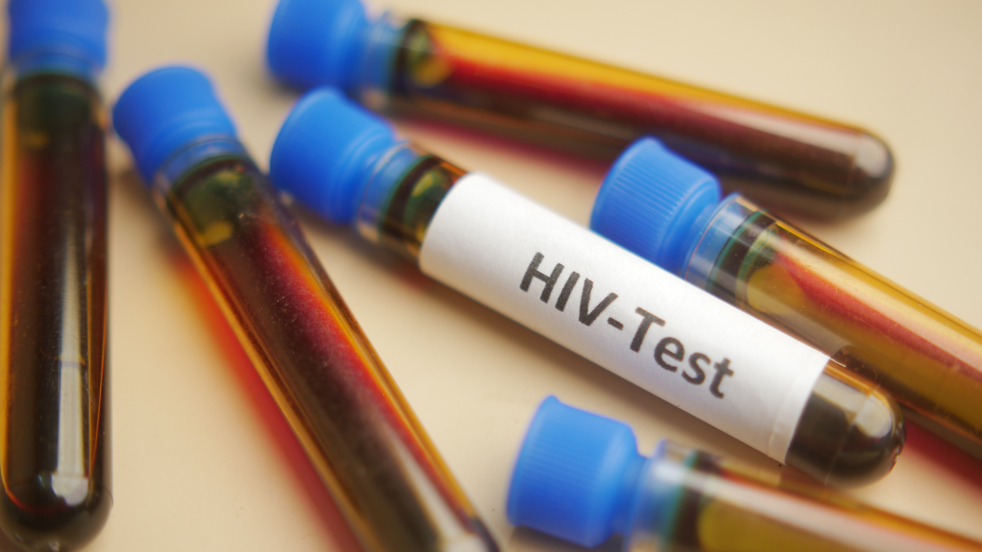 Test tubes for HIV testing
