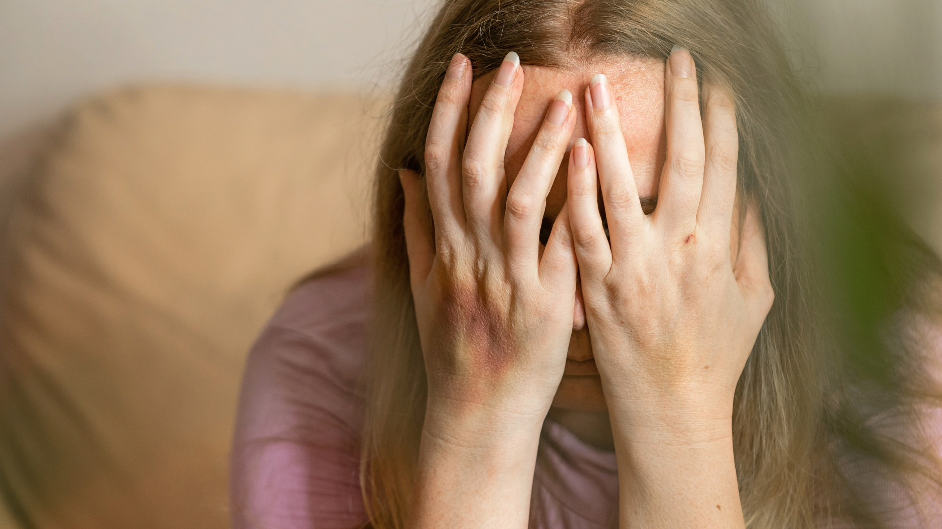 A woman covers her face with bruised hands